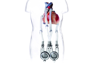 Ein schematisch dargestellter menschlicher Körper mit einem Herzen, an das Untersuchungsgeräte angeschlossen sind.